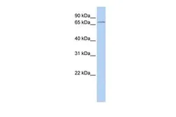 Anti-ALOX15B antibody, Internal used in Western Blot (WB). GTX47095