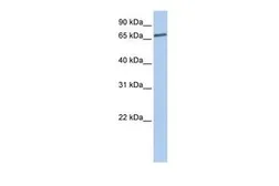 Anti-LSS antibody, N-term used in Western Blot (WB). GTX47109