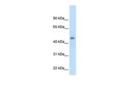 Anti-CYP3A7 antibody, Internal used in Western Blot (WB). GTX47116