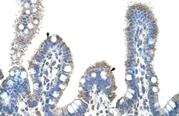 Anti-SLC22A1 antibody, C-term used in IHC (Paraffin sections) (IHC-P). GTX47131