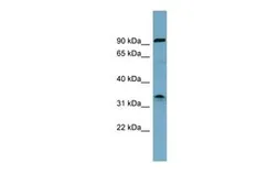 Anti-SDS antibody, Internal used in Western Blot (WB). GTX47142