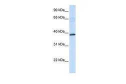 Anti-HAO2 antibody, N-term used in Western Blot (WB). GTX47157