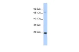 Anti-RBPMS2 antibody, Internal used in Western Blot (WB). GTX47183