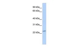 Anti-RBPMS2 antibody, Internal used in Western Blot (WB). GTX47184
