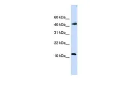 Anti-APOBEC3F antibody, C-term used in Western Blot (WB). GTX47211
