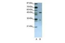Anti-UPF3B antibody, N-term used in Western Blot (WB). GTX47258