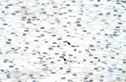 Anti-LSM2 antibody, Internal used in IHC (Paraffin sections) (IHC-P). GTX47264
