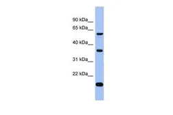 Anti-LARP6 antibody, Internal used in Western Blot (WB). GTX47282