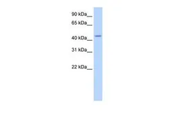 Anti-TRNT1 antibody, N-term used in Western Blot (WB). GTX47307