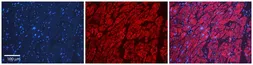 Anti-LSM1 antibody, Internal used in IHC (Paraffin sections) (IHC-P). GTX47320