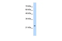 Anti-CPSF4 antibody, C-term used in Western Blot (WB). GTX47338