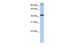 Anti-SFRS6 antibody, Internal used in Western Blot (WB). GTX47348