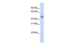 Anti-NELF-E antibody, N-term used in Western Blot (WB). GTX47389