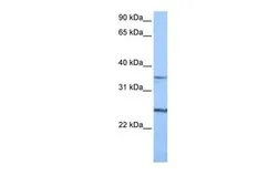 Anti-PIGF antibody, N-term used in Western Blot (WB). GTX47392