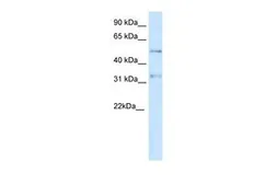 Anti-KCNAB2 antibody, Internal used in Western Blot (WB). GTX47447