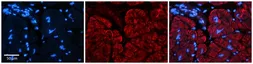 Anti-AKAP7 antibody, Internal used in IHC (Paraffin sections) (IHC-P). GTX47464