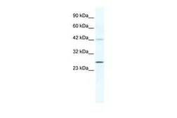 Anti-GJB4 antibody, Internal used in Western Blot (WB). GTX47479