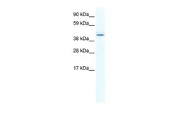 Anti-DDX49 antibody, N-term used in Western Blot (WB). GTX47505