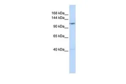Anti-DDX46 antibody, Internal used in Western Blot (WB). GTX47514