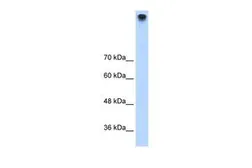 Anti-TRPM3 antibody, N-term used in Western Blot (WB). GTX47533