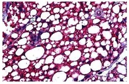 Anti-PBR antibody, C-term used in IHC (Paraffin sections) (IHC-P). GTX47548