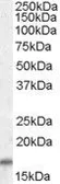 Anti-COX4I2 antibody, C-term used in Western Blot (WB). GTX47597