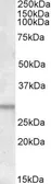 Anti-ATF5 antibody, C-term used in Western Blot (WB). GTX47605