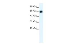Anti-KCNH5 antibody, N-term used in Western Blot (WB). GTX47623