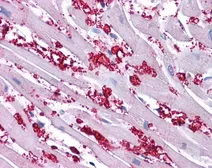 Anti-KCNA10 antibody, N-term used in IHC (Paraffin sections) (IHC-P). GTX47684