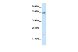 Anti-ASIC3 antibody, N-term used in Western Blot (WB). GTX47689