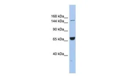 Anti-KIF15 antibody, Internal used in Western Blot (WB). GTX47727