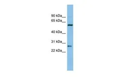 Anti-CTRB1 antibody, Internal used in Western Blot (WB). GTX47748