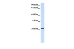 Anti-RAB18 antibody, C-term used in Western Blot (WB). GTX47773