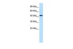 Anti-DLX2 antibody, N-term used in Western Blot (WB). GTX48461
