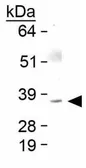 Anti-Bmi1 antibody used in Western Blot (WB). GTX48576