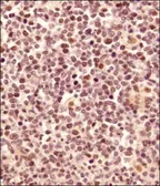 Anti-LMO2 antibody used in IHC (Paraffin sections) (IHC-P). GTX48597