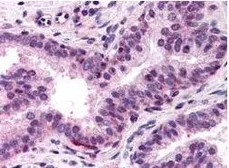 Anti-NFYA antibody used in IHC (Paraffin sections) (IHC-P). GTX48667
