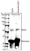 Anti-CLIC1 antibody, N-term used in Western Blot (WB). GTX48722