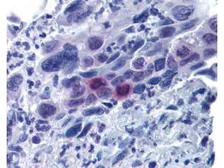 Anti-Mlf1 Interacting Protein (phospho Thr78) antibody used in IHC (Paraffin sections) (IHC-P). GTX48727