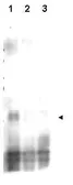 Anti-Mer2 (phospho Ser30) antibody used in Western Blot (WB). GTX48730