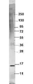 Anti-TNF alpha antibody used in Western Blot (WB). GTX48753