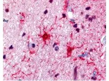 Anti-S100 antibody used in IHC (Paraffin sections) (IHC-P). GTX48819