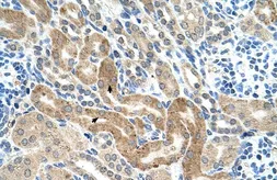 Anti-CHAF1B antibody, C-term used in IHC (Paraffin sections) (IHC-P). GTX48890