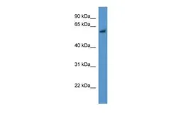 Anti-BBS1 antibody, N-term used in Western Blot (WB). GTX48923