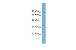 Anti-ETV2 antibody, N-term used in Western Blot (WB). GTX48974