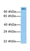 Anti-E2F7 antibody, N-term used in Western Blot (WB). GTX48989