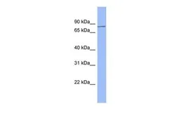 Anti-HDX antibody, N-term used in Western Blot (WB). GTX49005