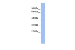 Anti-HDX antibody, Internal used in Western Blot (WB). GTX49006