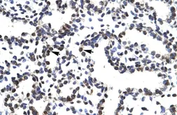 Anti-LHX3 antibody, Internal used in IHC (Paraffin sections) (IHC-P). GTX49065