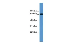 Anti-IMP3 antibody, Internal used in Western Blot (WB). GTX49088